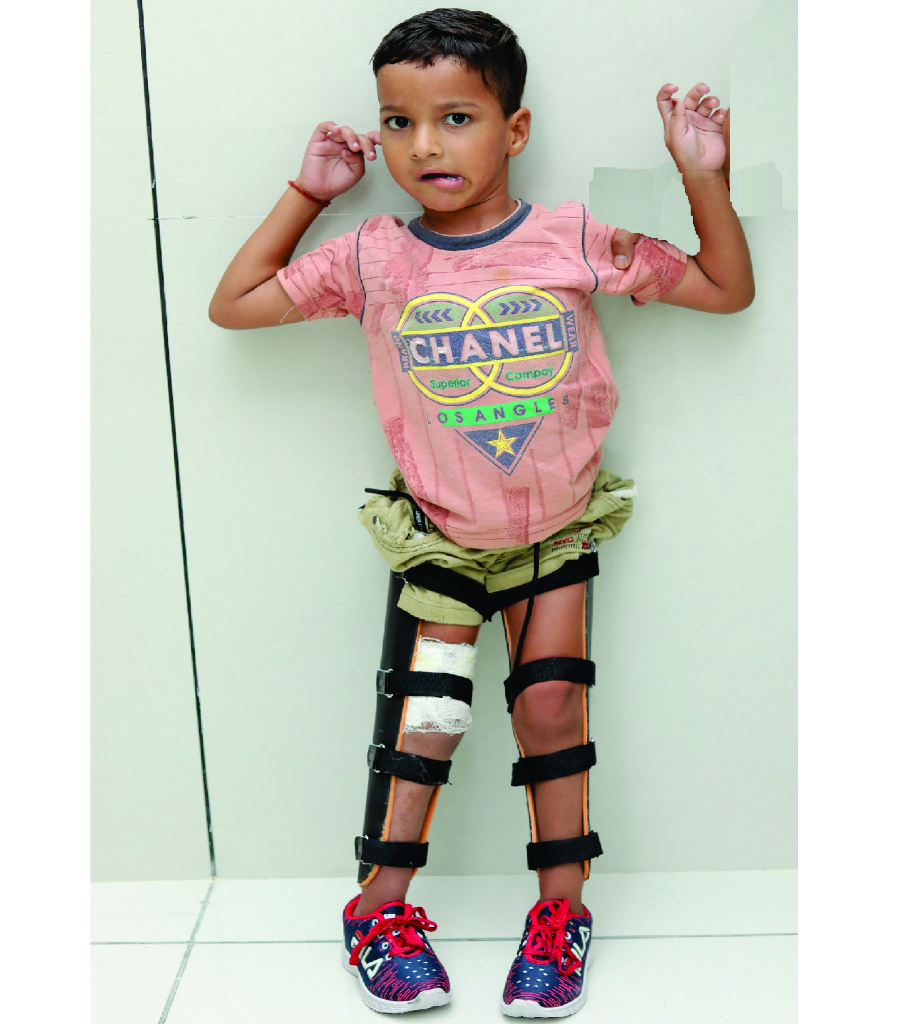 heal corrective surgery